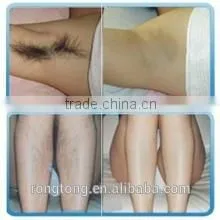 IPL Permanent Hair Removal at Home With Replaceable Lamp( Three Functions in One) photo-6
