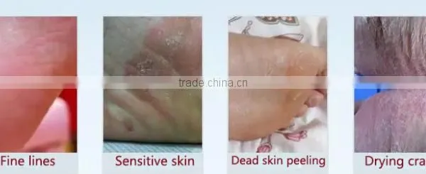 Guojia Peeling Foot Mask photo-4