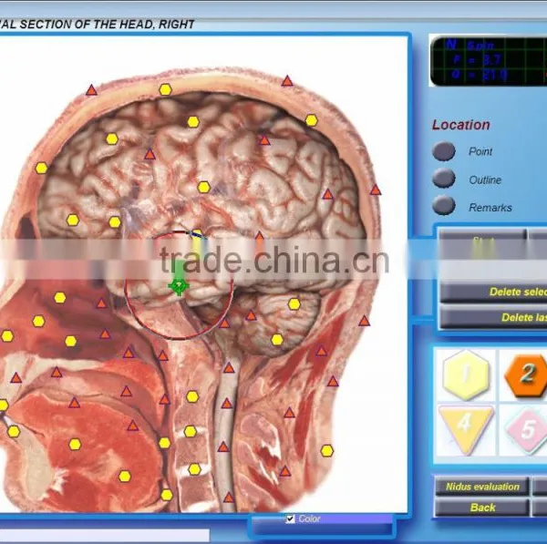Fast Detection Diacom 3D Body Health Analyzer photo-3