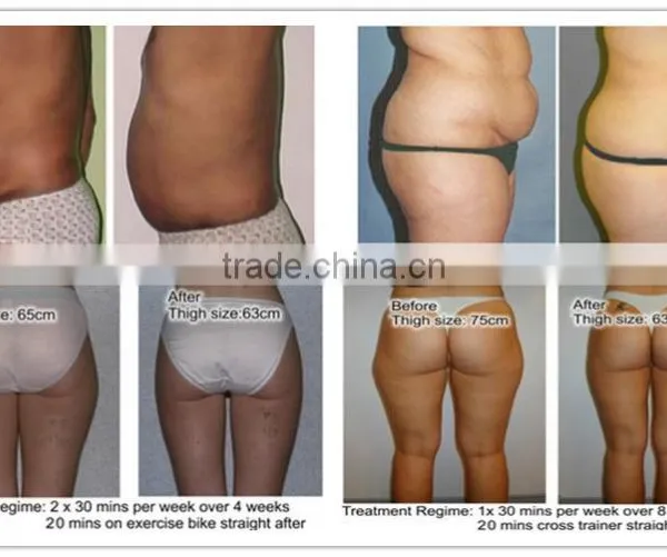 650nm Portable Lipo Diode Laser Slimming Machine for Sale photo-5