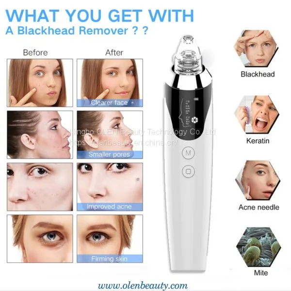 OLEN 2020 Home Use Portable Facial BlackHead Spot Acne Remover Machine Cleanser Comedo Cleaner for Black Head Removal Vacuum Device photo-2