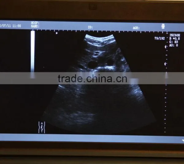 Full Digital Laptop Ultrasound Machine With Low Price photo-2
