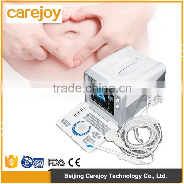 Medical Hospital Ultrasound Diagnostic Machine Portable Ultrasound Equipment photo-4