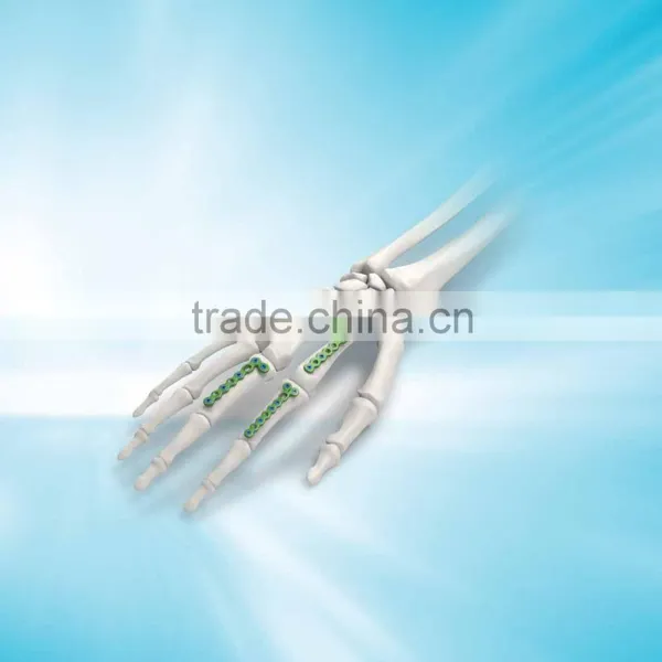 Since 1958 Bone Implant Medical Instrument Supplies,orthopedic Implants,locking Plate,orthopaedic 2.0 Straight Locking Plate