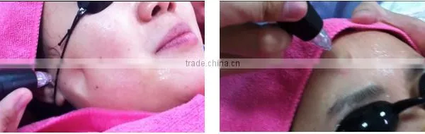 Portable Facial Machine 2016 Mini Portable Water Oxygen Spary Skin Rejuvenation/water Oxygen Jet Peel Machine Diamond Dermabrasion photo-5