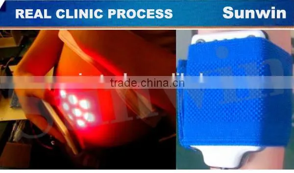 Best Cellulite Fat Removal Machine With Multi Languages System photo-5