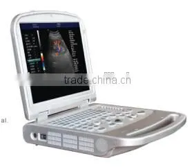 15 Inch Laptop Color Doppler 64G Image-storage Capacity Ultrasound Scanner for Hospital photo-2