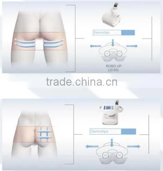 Professional Radio Frequency Cellulite Roller Massage Fat Dissolving Machine - Cellactor photo-6