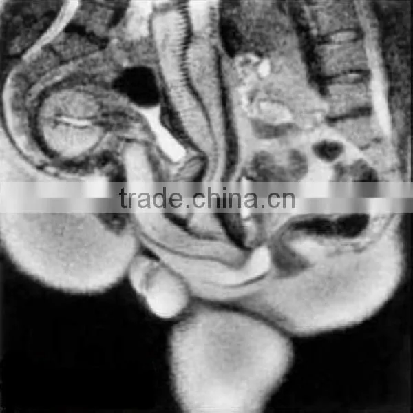 Radiology Medical Film