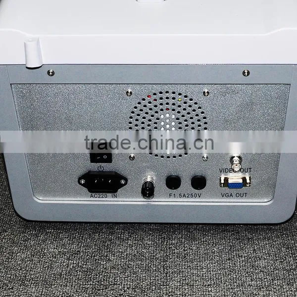 10 Inch Cheap Ultrasound Scanner Diagnostic System RUS 6000D With 3.5MHz Convex Probe 18 Months Warranty photo-4