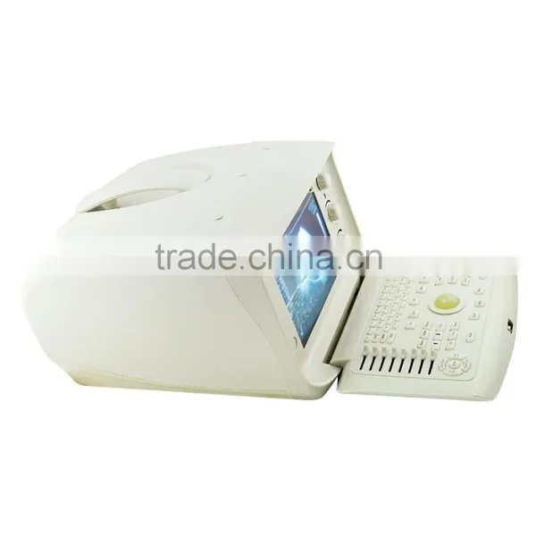 Cheap Price Digital Portable Ultrasound Machine/Scanner With Convex/linear/transvaginal Probe photo-2
