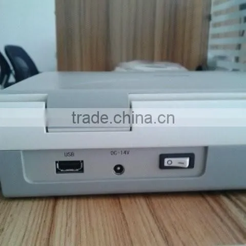 Portable Ultrasonic Diagnostic Devices , Laptop Portable Ultrasound Machine & Ultrasound Scanner photo-3