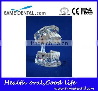 Dental Adult Pathological Dentition Model DEA-48 Teeth Model Teaching Demonstration photo-2