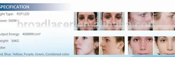 Freckle Removal      630nm Blue PDT Machine Spot Removal photo-6