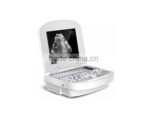 China Beijing 10.7 Inch Color LCD 2B Ultrasound Imaging System Laptop Ultrasound Scanner With CE ISO Approved photo-5