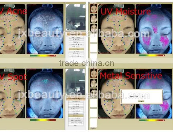 Skin Analyzer uv Damage photo-6
