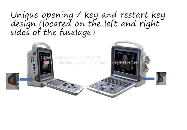 Portable Color Doppler Ultrasound Scanner System photo-3