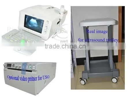 CE Approved Portable B-Mode Ultrasound Scanner With 3.5Mhz Multi-frequency Convex Probe RUS-6000A photo-2