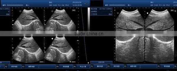 Best Price Pocket Ultrasonic Diagnostic Wireless Ultrasound Probe 10 Years Export Experience Supplier -WBU01 photo-6