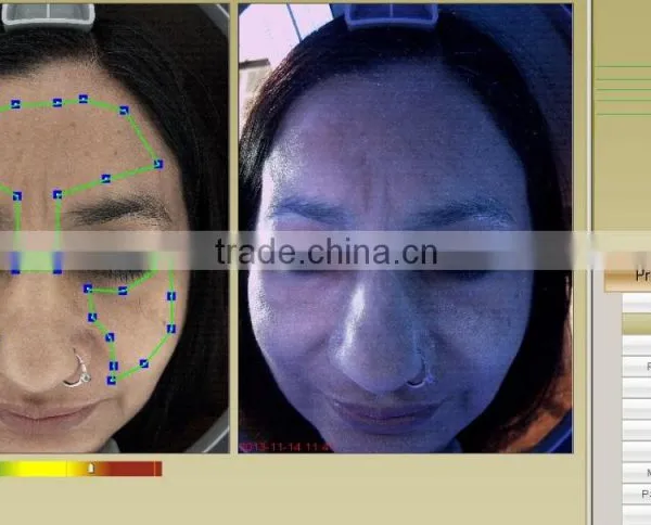 Salon & Cinilic Beauty Machine Skin Diagnose Magic Mirror/skin Analyzer/skin Tester photo-4
