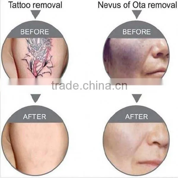 Best China Hot Sale!! Super Fast Color Touch Screen Anti Wrinkle Laser 10HZ photo-6