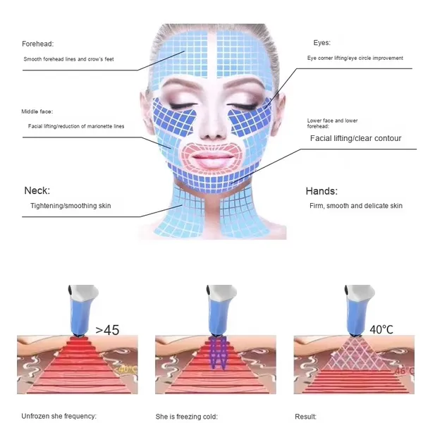 Multi-Function Anti-Aging Device: RF, EMS, LED for Face & Body photo-5