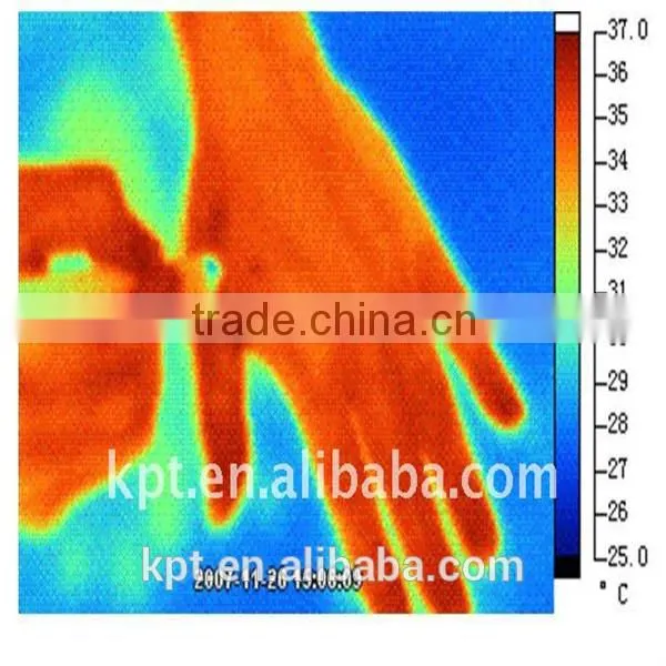 100mw KPT Physiotherapy Acupuncture IR Pen