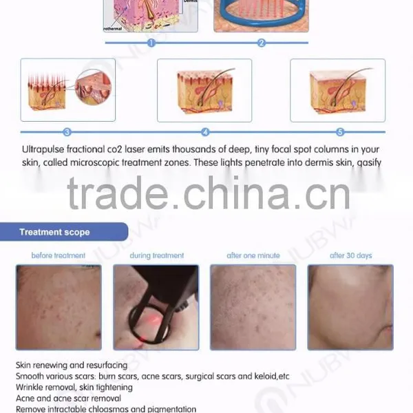 Stretch Mark Removal Medical CE Pigment Removal 30W Co2 Wrinkle Removal Fractional Machine With USA Coherent Laser photo-3