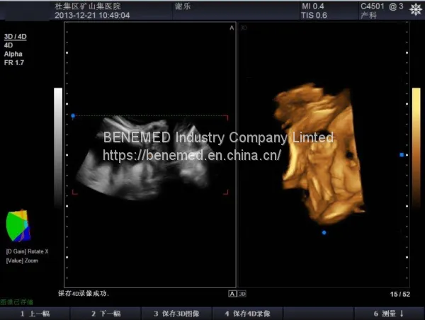 Trolly Based Color Doppler System Ultrasound Diagnostic Scanner photo-4