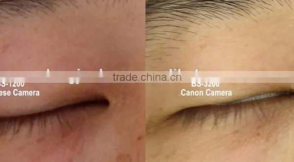 Skin Analysis System A-one With Pre-set Well Skin Analysis Software photo-2