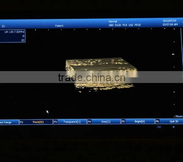 2016 New Laptop Ultrasound Machine / Scanner PC Platform With CE ISO Certification photo-4