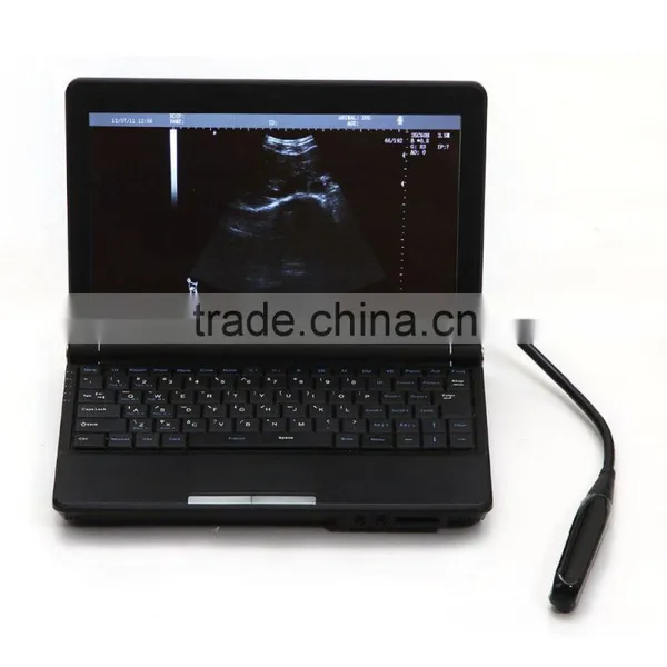 2016 New Veterinary Full Digital Laptop Ultrasound Machine With Low Price photo-2