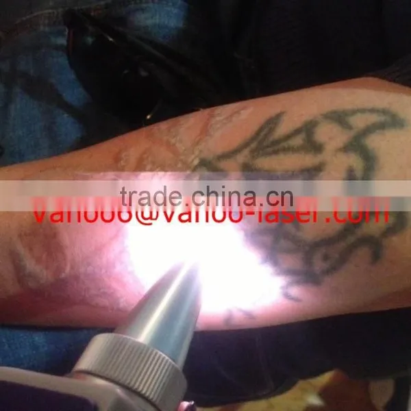 *Stationary 1064 nm 532nm Q-swithed Nd-yag Laser Alexandrite Laser Tattoo Removal Beauty Machine photo-2