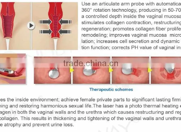 Painless Portable 2016 Newest Laser Beauty Equipment Pixel Rf Co2 Fractional Laser For Stretch Marks Removal 10.6um Fine Lines Removal photo-6