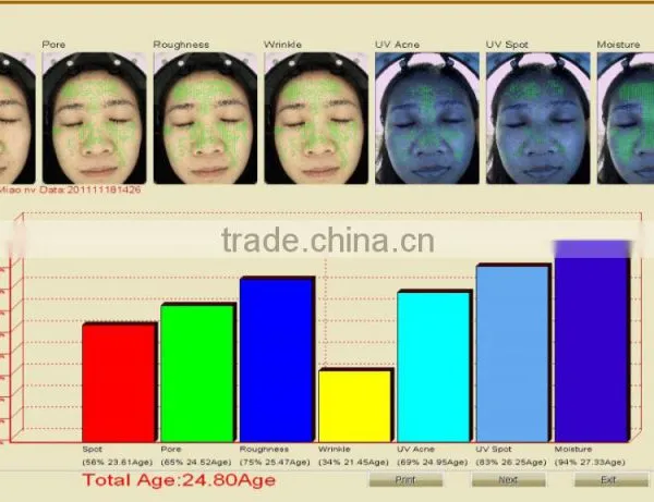 Portable Dialysis Machine/facial Skin Analyzer Machine Skin Scan/skin Analyser for Face photo-5