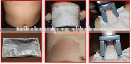 Weight Loss Five Heads Fat Reduce Cryolipolysis Machine With CE Approved / Slimming Machine /lose Weight Machine (CE Approved) Body Slimming photo-2