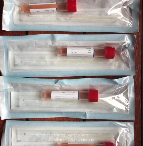 PCR Rapid Test Kit Card CE Mark, IN STOCK photo-5