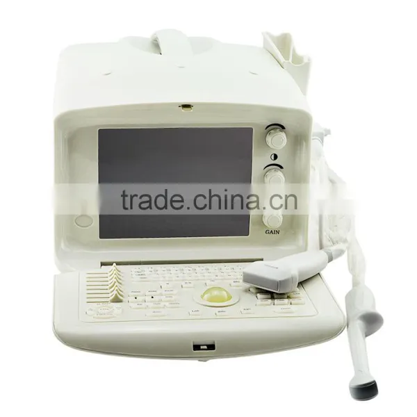 Cheap Prices of Medical Ultrasound Machine for Pregnancy photo-3