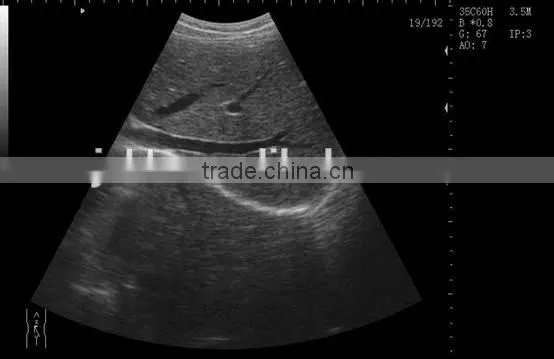 CE Approved Laptop Ultrasound Scanner With 3.5Mhz Multi-frequency Convex Probe RUS-9000F photo-2