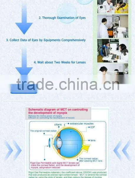 Web High-end MCT Technology MCT for Adult Amblyopia photo-3