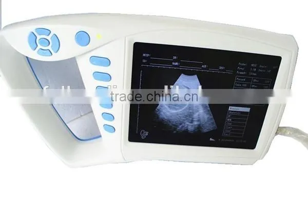 FM-9004H Portable Palm Ultrasound Scanner for Medical