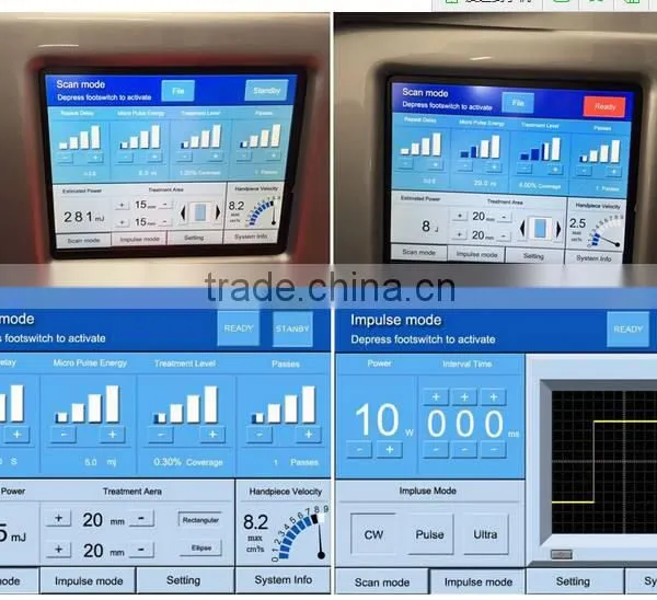 Birth Mark Removal Sanhe Best Quality Multifunction Dermatology Sc-2 10600nm 10600 Nm Laser Co2 Fractional Machine/co2 Freckle Removal Device photo-4