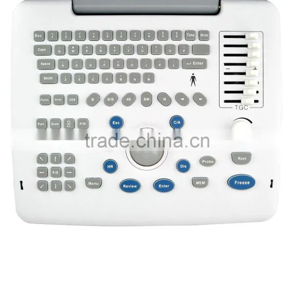 High Performance Low Price Ultrasound Machine photo-3