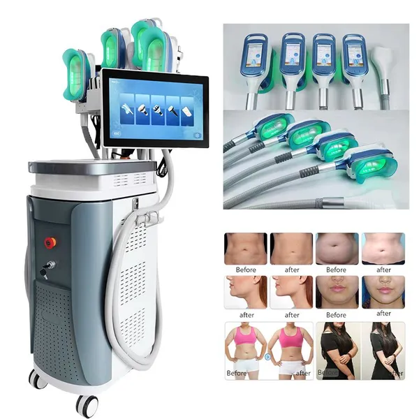 Factory Direct 5 in 1 Cryolipolysis Machine - 1 Year Warranty, Free Installation & Operation Guide, 360° Cryo Body Slimming, Standard Compliant photo-3