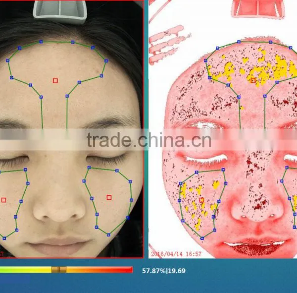High Pixel Skin Pigmentation/acne/spot/pore/wrinkle/roughness/sensitivity/cosmetics Test Machine photo-6