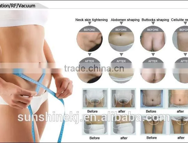 Cavitation+Vacuum+RF for Salon Use/best rf Skin Tightening Face Lifting Machine photo-3