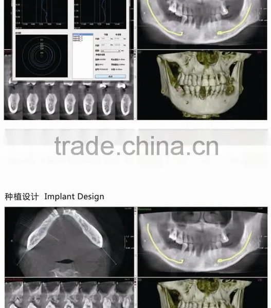 Digital 3D Intra-oral Imaging X-ray Machine photo-2