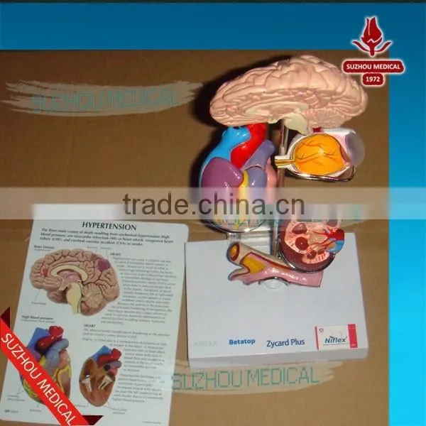 Effects of Hypertension, 5 Parts photo-3