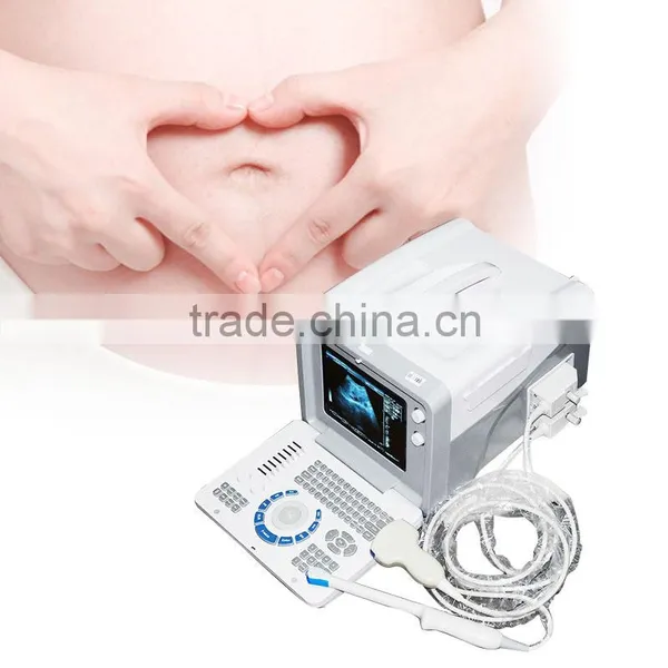 Hot Recommend Cheap Price Portable Ultrasound Scanner/Machine With Convex, Linear Probe/Transducers and Sony Printer RUS-6000D photo-6