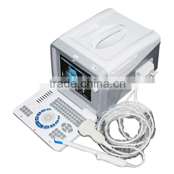 Low Cheap Portable Ultrasound Scanner 10 Inch Optional Video Thermal Recorder photo-5